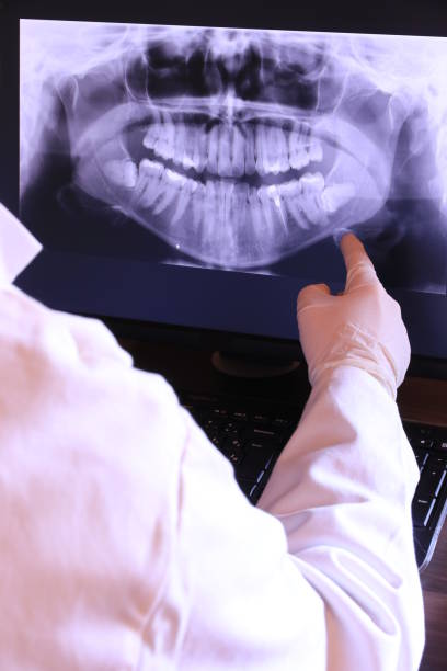 Best Broken or Chipped Tooth Repair in Rainier, WA