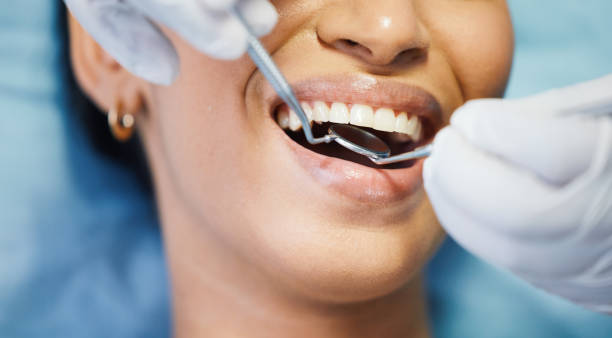 Best Emergency Dental Care for Sports Injuries in Rainier, WA